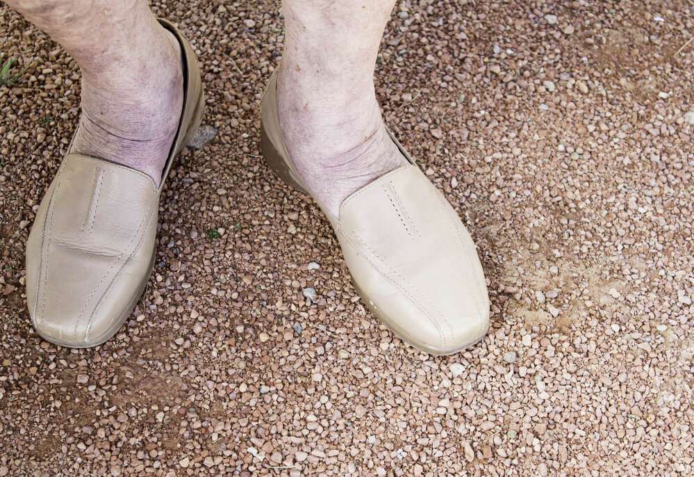 sapatos ortopedicos feminino