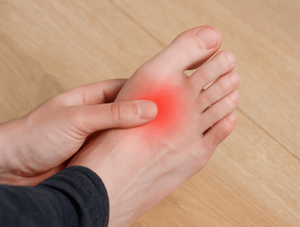 Neuroma de Morton