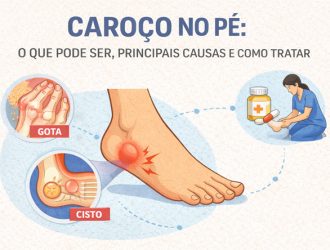 Caroço no Pé