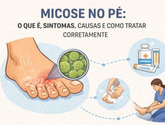 Micose no Pé